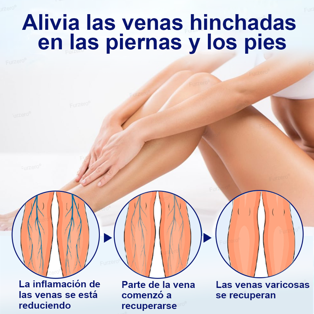 🏆🏆Hecho y enviado desde México🌿Furzero® VeinFreedom Spray Herbario - Terapia de MicroNiebla
