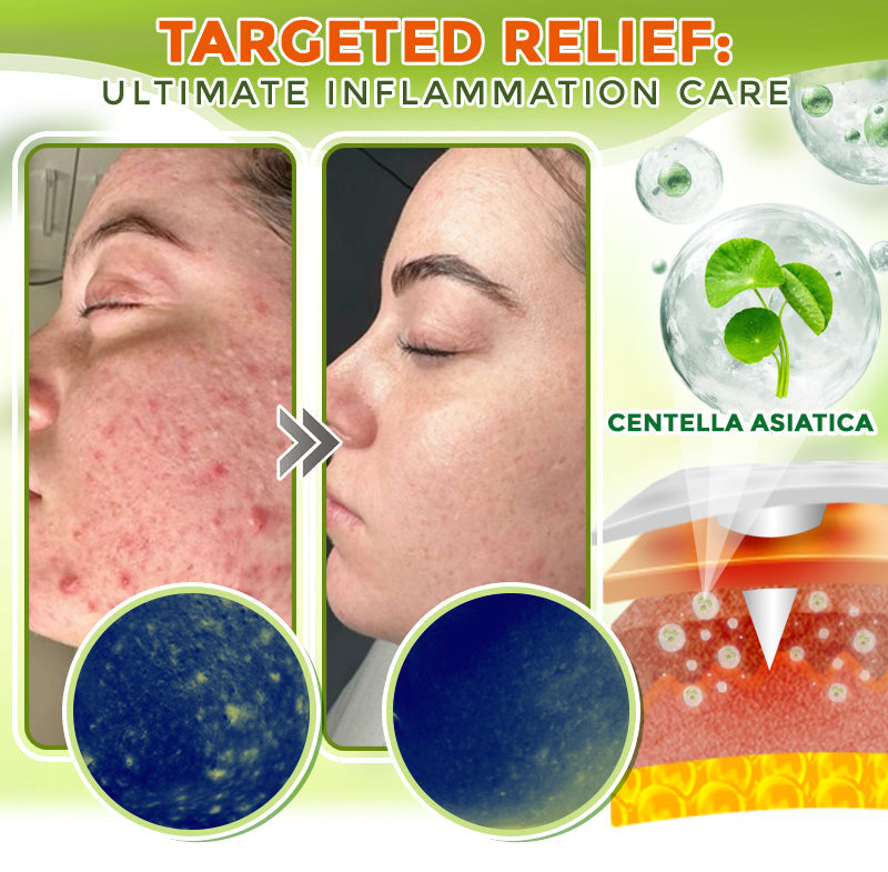GFOUK® Parche Avanzado de Microagujas