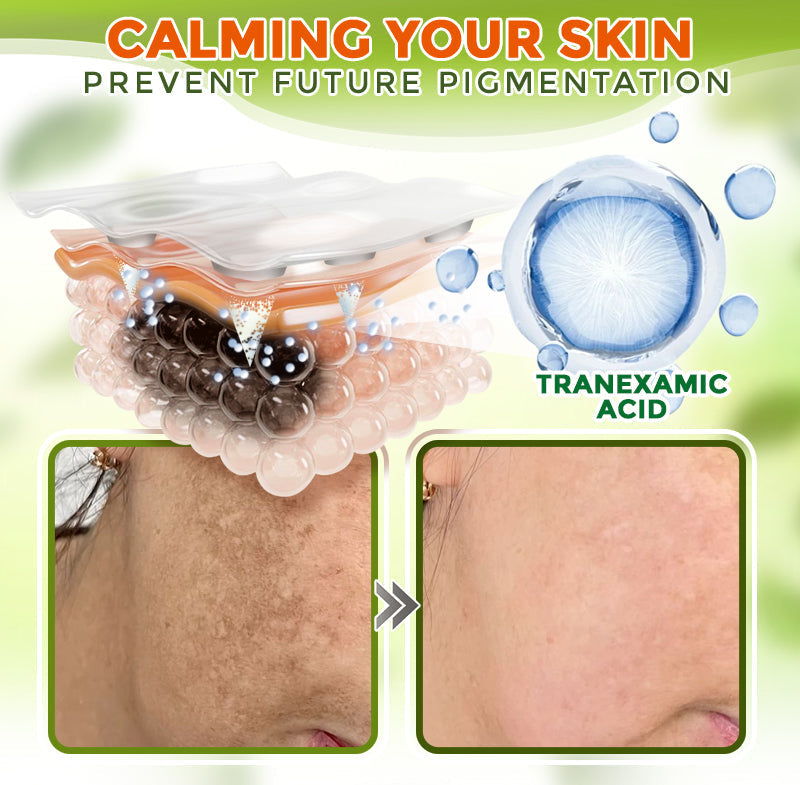 GFOUK® Parche Avanzado de Microagujas