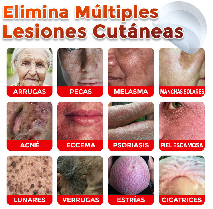 𝖱𝖾𝖼𝗈𝗆𝖾𝗇𝖽𝖺𝖽𝗈 𝗉𝗈𝗋 𝙙𝙤𝙘𝙩𝙤𝙧𝙚𝙨👨🏽⚕️GFOUK® Parche Botánico de Microagujas para Eliminar Verrugas y Acrocordones 🇲🇽 Producto 100%