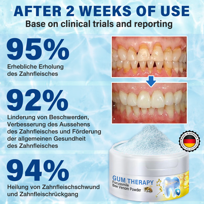 🇲🇽❤️ Furzero® 𝑭𝒐𝒄𝒖𝒔𝒔𝒎𝒊𝒍𝒆 – Polvo de tratamiento bucal con veneno de abeja 🦷